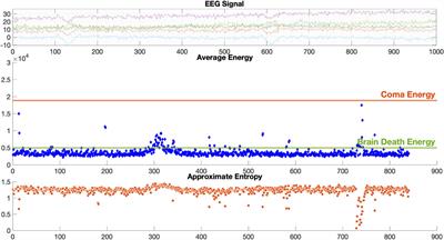 EEG-based real-time diagnostic system with developed dynamic 2TEMD and dynamic ApEn algorithms